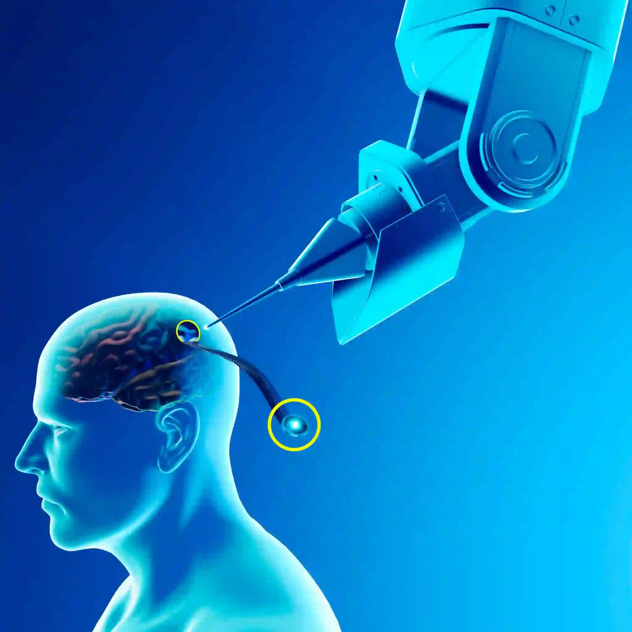 “Futuristic Neuralink brain implant technology enabling mind-controlled digital interaction”